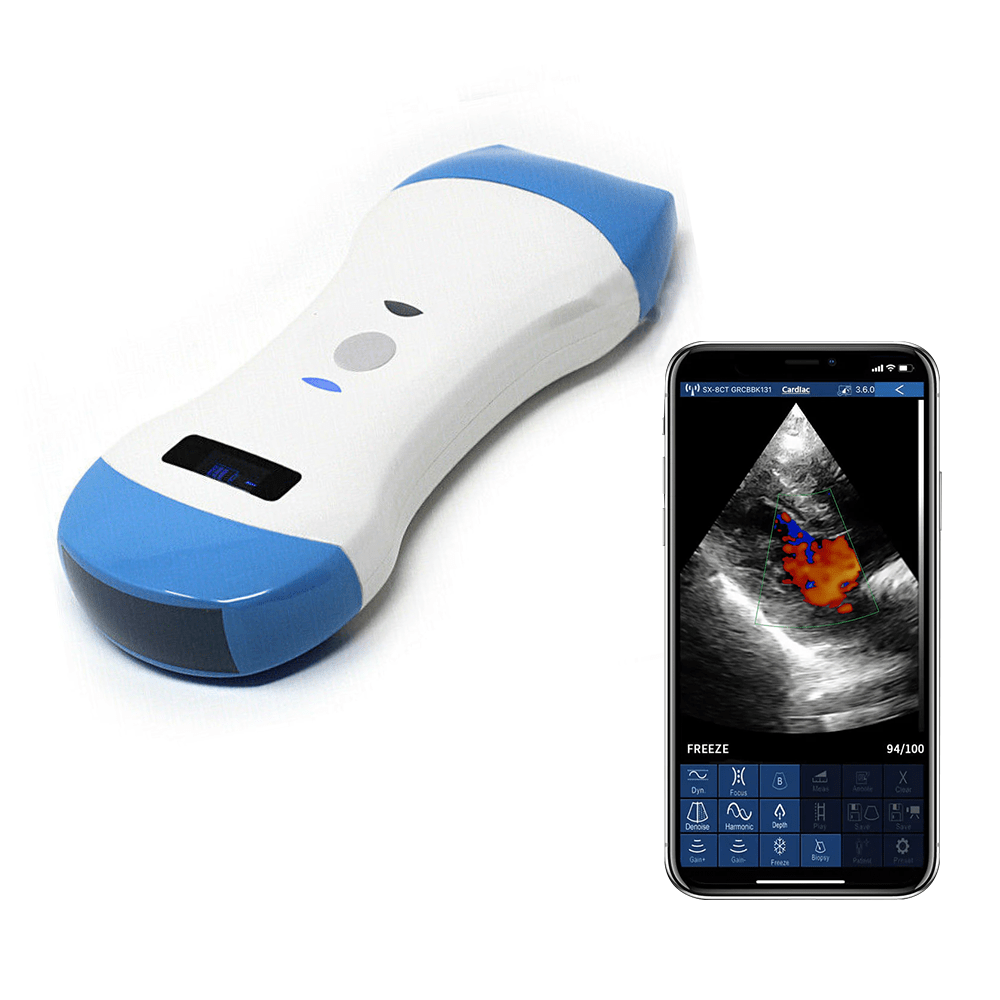 portable ultrasound